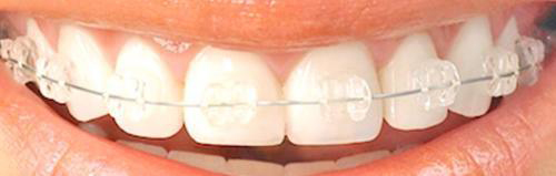 ホワイトワイヤー